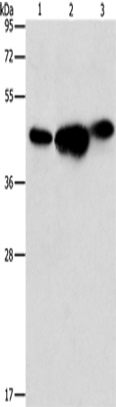 Gel: 10%SDS-PAGE Lysate: 40 microg Lane 1-3: 293T cells PC3 cells NIH/3T3 cells Primary antibody: TA364606 (ARFGAP1 Antibody) at dilution 1/850 Secondary antibody: Goat anti rabbit IgG at 1/8000 dilution Exposure time: 10 seconds