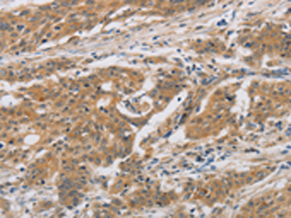 Surface staining of human MCF-7 cell line with anti-human CD326 / EpCAM (VU-1D9) APC.
