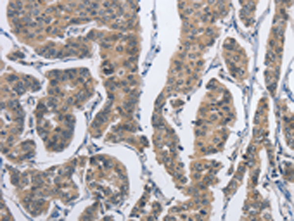 Western blot analysis of Rat colon probed withCD326 / EPCAM / TACSTD1 Antibody Cat.-No AM33248SU (Clone SPM535).
