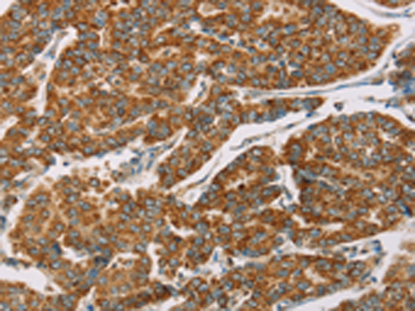 Western blot analysis of GFAP in Human brain lysate using GFAP Antibody (Clone SPM507).
