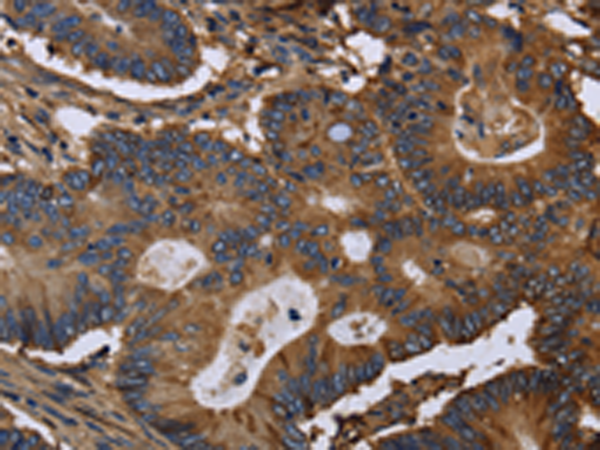 Formalin-Paraffin tonsil stained with Biotinylated Lambda Light Chain probe followed by Biotin Antibody AM33281PU (Clone SPM375). Note cell membrane &amp; cytoplasmic staining.