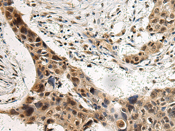 Formalin-paraffin human tonsil stained with Plasma Cell Marker MAb (Clone SPM310).