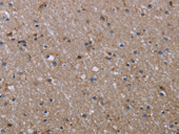 Formalin-fixed, paraffin-embedded Human Pancreas stained with Golgi Monoclonal Antibody (Clone 371-4).