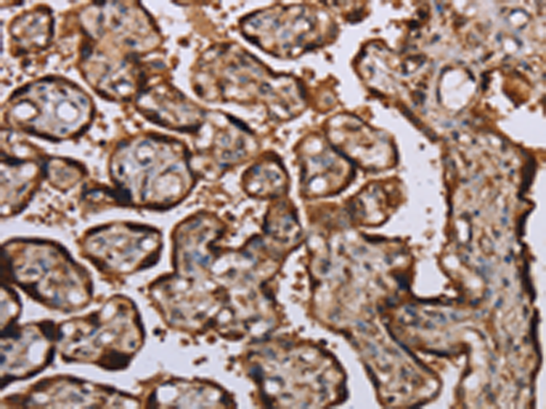 Immunohistochemistry of paraffin-embedded Human placenta tissue using TA364865 (KIF1C Antibody) at dilution 1/60 (Original magnification: x200)