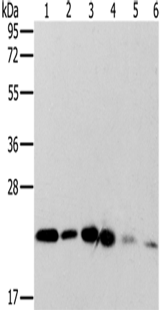 Gel: 10%SDS-PAGE Lysate: 40 microg Lane 1-6: Hela cells hepg2 cells lncap cells K562 cells Jurkat cells A549 cells Primary antibody: TA364890 (MRPL11 Antibody) at dilution 1/300 Secondary antibody: Goat anti rabbit IgG at 1/8000 dilution Exposure time: 15 seconds