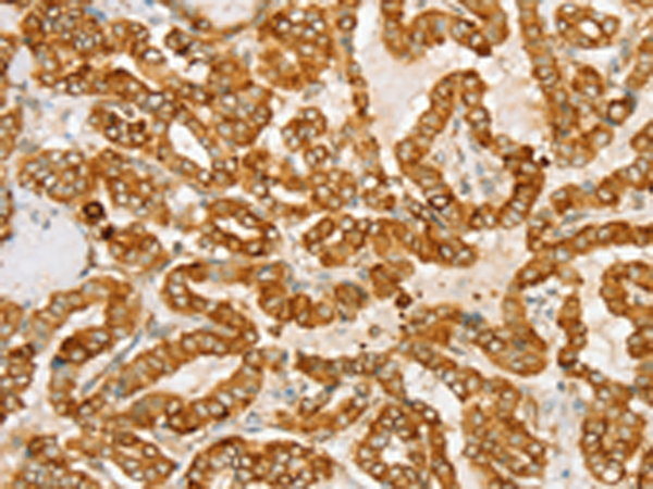 Formalin-Paraffin Human pancreas stained with Ins ulin Antibody (Clone E2-E3+2D11-H5). Note cytoplasmic staining of cells.
