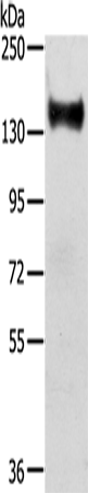 Gel: 6%SDS-PAGE Lysate: 40 microg Lane: Mouse brain tissue Primary antibody: TA364958 (RASAL2 Antibody) at dilution 1/350 Secondary antibody: Goat anti rabbit IgG at 1/8000 dilution Exposure time: 10 seconds
