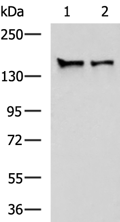 Gel: 6%SDS-PAGE Lysate: 40 microg Lane 1-2: 293T and Hela cell lysates Primary antibody: TA364994 (STAG1 Antibody) at dilution 1/800 Secondary antibody: Goat anti rabbit IgG at 1/5000 dilution Exposure time: 1 minute
