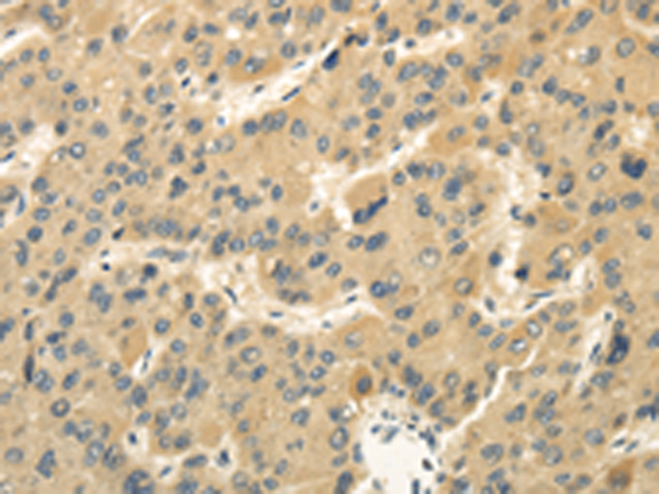 Staining with clone HD37 (CD19) monoclonal antibodies is illustrated by flow cytometry analysis of normal blood cells. Direct staining was performed using 10 ul of the PE - conj ugated antibody with 100 ul blood sample.