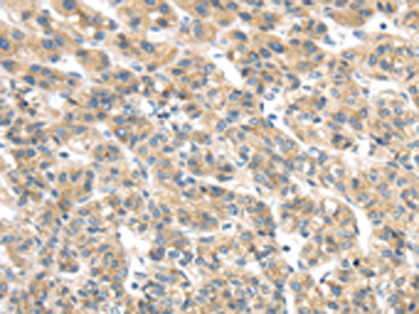 Representative data Anti-CD43, clone MT1, was analyzed by flow cytometry using a blood sample from a healthy donor. The cytogram shows direct staining with 10 ul anti-CD43 FITC and 100 ul of whole blood.