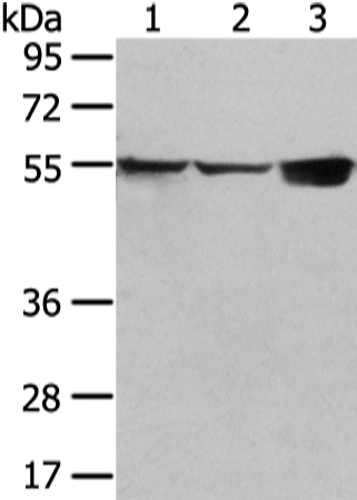 Gel: 6%SDS-PAGE Lysate: 40 microg Lane 1-3: 231 and hela cell mouse liver tissue Primary antibody: TA365120 (UGT1A10 Antibody) at dilution 1/300 Secondary antibody: Goat anti rabbit IgG at 1/8000 dilution Exposure time: 10 seconds