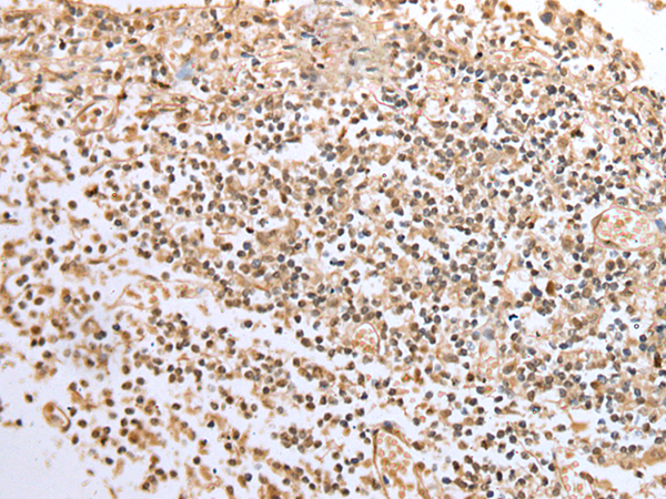 Immunohistochemistry of paraffin-embedded Human tonsil tissue using TA365243 (BCL7A Antibody) at dilution 1/20 (Original magnification: x200)