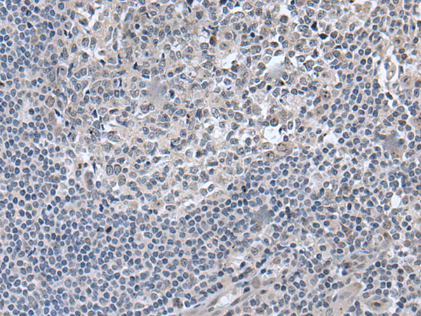 Immunohistochemistry of paraffin-embedded Human tonsil tissue using TA365280 (EDARADD Antibody) at dilution 1/50 (Original magnification: x200)