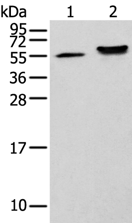 Gel: 12%SDS-PAGE Lysate: 40 microg Lane 1-2: A431 cell and Human fetal brain tissue Primary antibody: TA365282 (CAPS2 Antibody) at dilution 1/200 Secondary antibody: Goat anti rabbit IgG at 1/8000 dilution Exposure time: 20 seconds