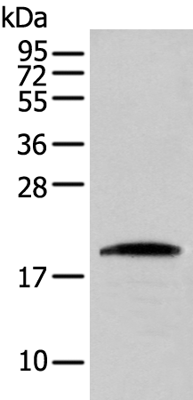 Gel: 12%SDS-PAGE Lysate: 40 microg Lane: HEPG2 cell Primary antibody: TA365285 (CNPY2 Antibody) at dilution 1/300 Secondary antibody: Goat anti rabbit IgG at 1/8000 dilution Exposure time: 20 seconds