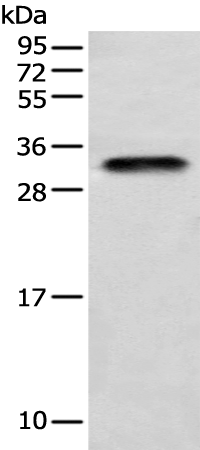 Gel: 12%SDS-PAGE Lysate: 40 microg Lane: Human testis tissue Primary antibody: TA365310 (LYPD4 Antibody) at dilution 1/400 Secondary antibody: Goat anti rabbit IgG at 1/8000 dilution Exposure time: 1 minute