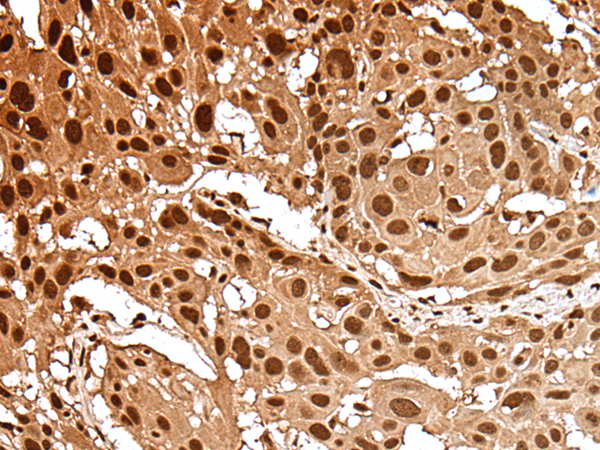Formalin-Fixed, Paraffin-Embedded normal Human small intestine stained with Secretory Component Antibody (Clone SPM217). Note cytoplasmic and membrane staining.