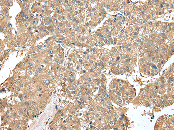 Formalin-Paraffin Human pancreas stained with Ins ulin Antibody (Clone SPM531). Note cytoplasmic staining of cells.