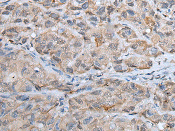 Western blot of HeLa lysate using CK17 Antibody (Clone SPM560).