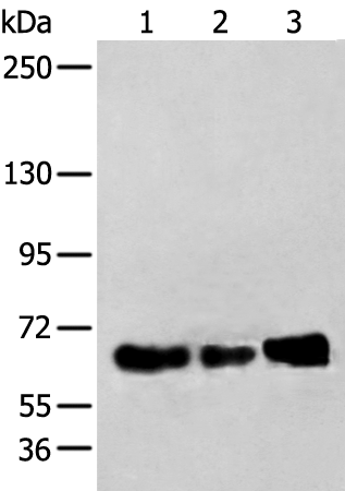 Gel: 6%SDS-PAGE Lysate: 40 microg Lane 1-3: TM4 K562 and A431 cell lysates Primary antibody: TA365371 (ZBTB5 Antibody) at dilution 1/250 Secondary antibody: Goat anti rabbit IgG at 1/8000 dilution Exposure time: 20 seconds