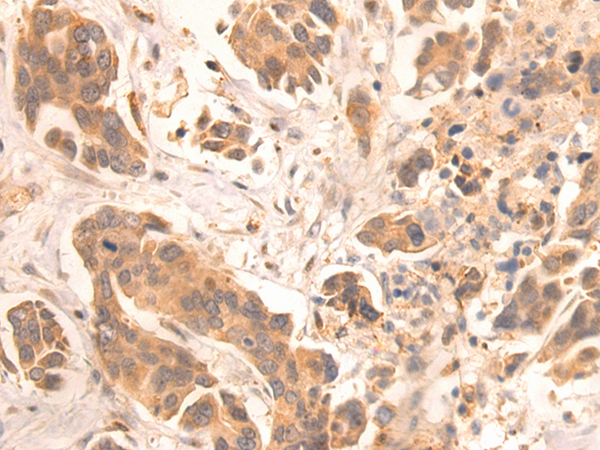 Formalin-paraffin human testis stained with MAGE-1 Antibody (Clone SPM282).