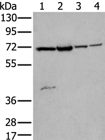 Gel: 6%SDS-PAGE Lysate: 40 microg Lane 1-4: Hela and Jurkat cell lysates Rat brain tissue and Human testis tissue lysates Primary antibody: TA365380 (ZNF131 Antibody) at dilution 1/200 Secondary antibody: Goat anti rabbit IgG at 1/8000 dilution Exposure time: 15 seconds
