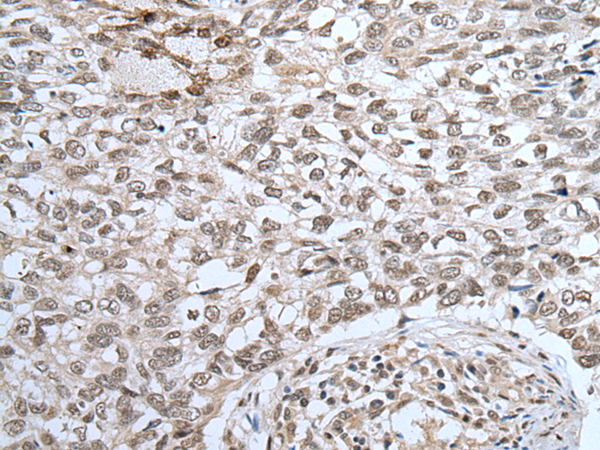 Formalin-paraffin human cerebellum stained with Neurofilament Antibody (Clone SPM563).