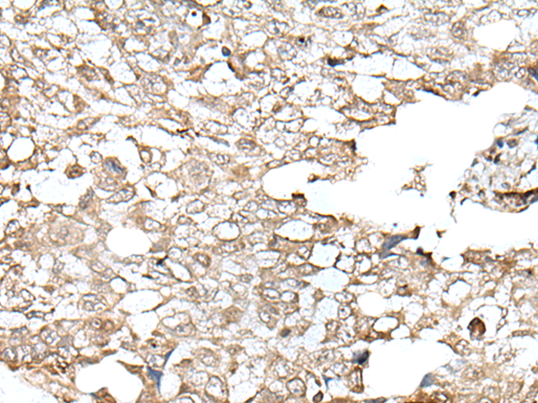 Formalin-paraffin human tonsil stained with PCNA Antibody (Clone SPM350)
