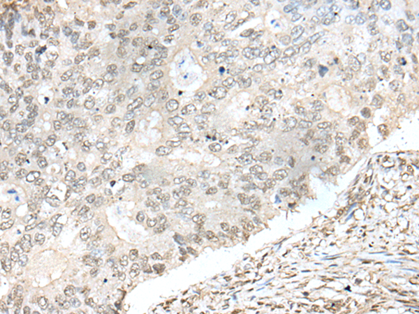 Formalin-paraffin human tonsil stained with PCNA Antibody (Clone SPM350)