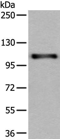 Gel: 6%SDS-PAGE Lysate: 40 microg Lane: A431 cell lysate Primary antibody: TA365441 (USO1 Antibody) at dilution 1/200 Secondary antibody: Goat anti rabbit IgG at 1/8000 dilution Exposure time: 40 seconds