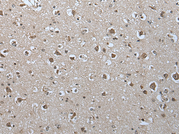 Formalin-Paraffin Human tonsil stained with CD44 Antibody (Clone SPM544).