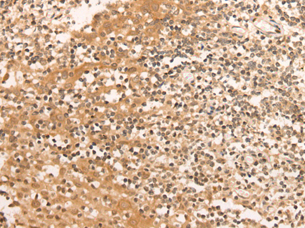 Immunohistochemistry of paraffin-embedded Human tonsil tissue using TA365493 (UTY Antibody) at dilution 1/30 (Original magnification: x200)