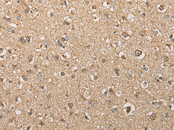 Immunohistochemistry of paraffin-embedded Human brain tissue using TA365516 (BCO2 Antibody) at dilution 1/30 (Original magnification: x200)