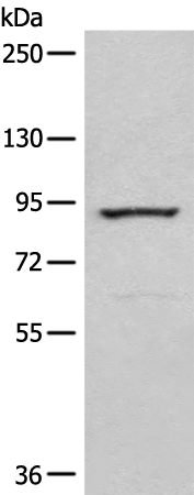 Gel: 6%SDS-PAGE Lysate: 40 microg Lane: Jurkat cell lysate Primary antibody: TA365570 (CAGE1 Antibody) at dilution 1/250 Secondary antibody: Goat anti rabbit IgG at 1/8000 dilution Exposure time: 30 seconds