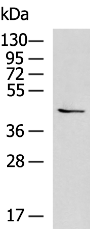 Gel: 8%SDS-PAGE Lysate: 40 microg Lane: PC-3 cell lysate Primary antibody: TA365645 (CHST10 Antibody) at dilution 1/900 Secondary antibody: Goat anti rabbit IgG at 1/5000 dilution Exposure time: 1 minute