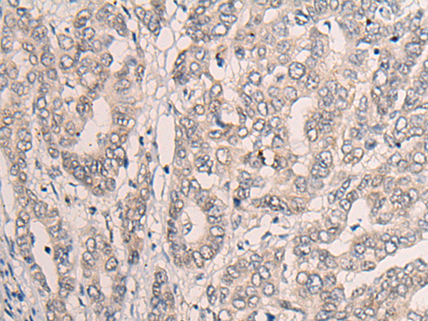 Western blot analysis of ODC1 in human placental lysate using ODC-1 Antibody (Clone ODC1/485).
