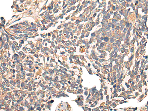 Western blot analysis of PAX6 in human cerebellum lysate using PAX6 Antibody (Clone PAX6/498).