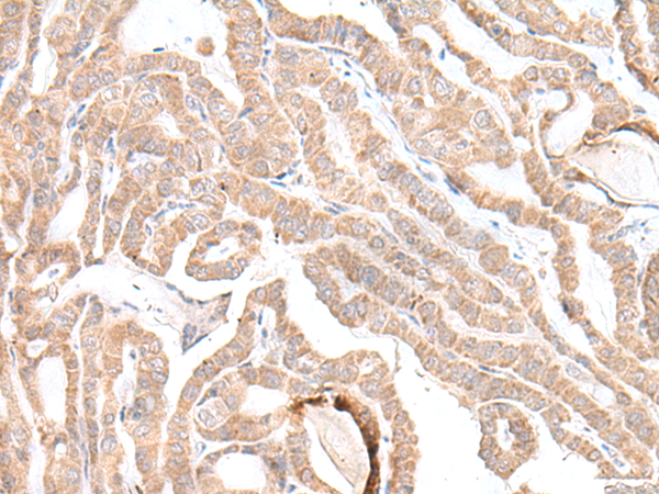 TUBB3/TUBB4 antibody staining of Rat Skin Paraffin Section.