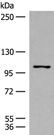 Gel: 6%SDS-PAGE Lysate: 40 microg Lane: TM4 cell lysate Primary antibody: TA365941 (RNF111 Antibody) at dilution 1/200 Secondary antibody: Goat anti rabbit IgG at 1/8000 dilution Exposure time: 1 minute