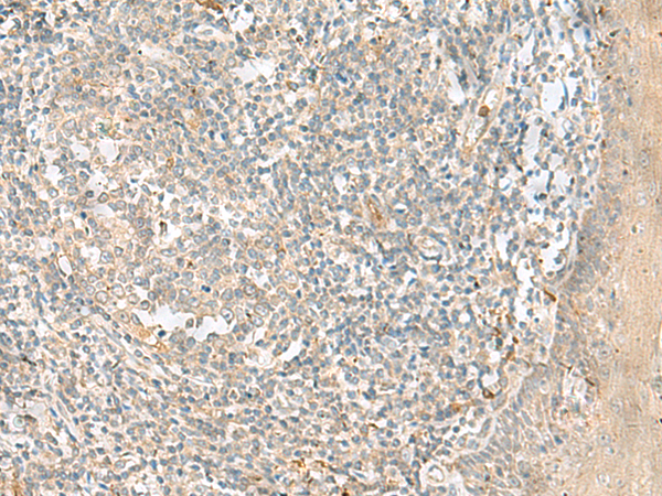 Immunohistochemistry of paraffin-embedded Human tonsil tissue using TA366021 (TTLL1 Antibody) at dilution 1/90 (Original magnification: x200)