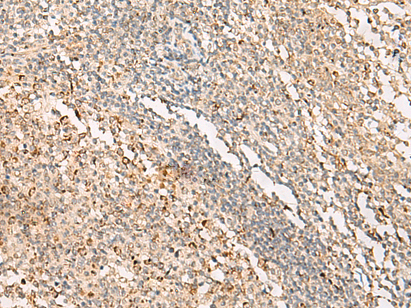 Immunohistochemistry of paraffin-embedded Human tonsil tissue using TA366035 (PTGES3L-AARSD1 Antibody) at dilution 1/35 (Original magnification: x200)
