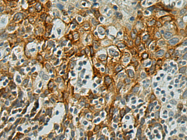 Immunohistochemistry of paraffin-embedded Human tonsil tissue using TA366065 (ATP6V0A1 Antibody) at dilution 1/180 (Original magnification: x200)