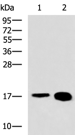 Gel: 12%SDS-PAGE Lysate: 40 microg Lane 1-2: Mouse skeletal muscle tissue Rat heart tissue lysates Primary antibody: TA366099 (LBH Antibody) at dilution 1/800 Secondary antibody: Goat anti rabbit IgG at 1/5000 dilution Exposure time: 2 minutes