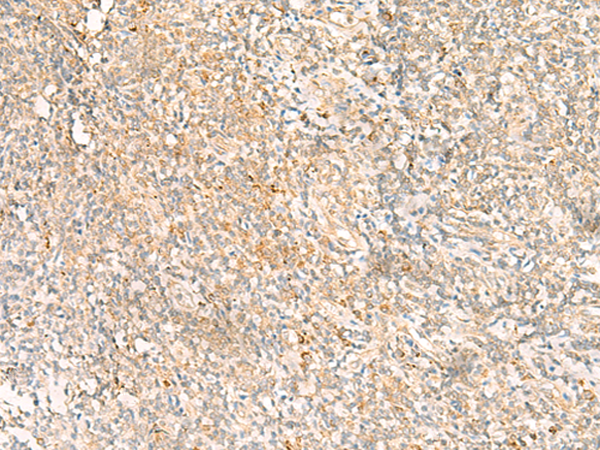 Immunohistochemistry of paraffin-embedded Human tonsil tissue using TA366110 (MTHFD2L Antibody) at dilution 1/20 (Original magnification: x200)