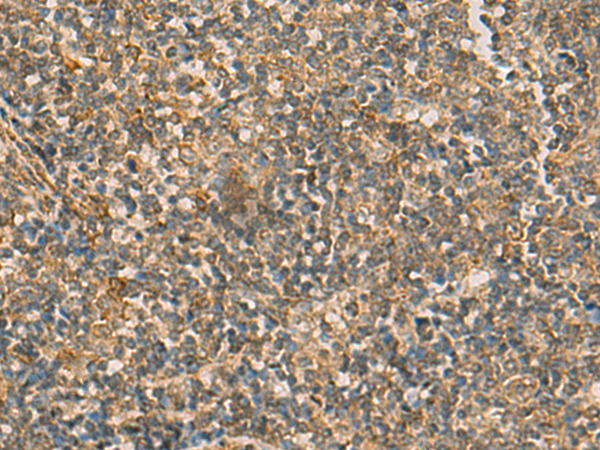 Staining of rat peritoneal macrophages cells with Mouse Anti RAT CD68 antibody RPE conj ugated (BM4000R).