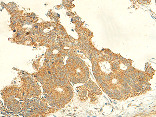 Staining of rat peritoneal macrophages with MOUSE ANTI RAT CD163: FITC