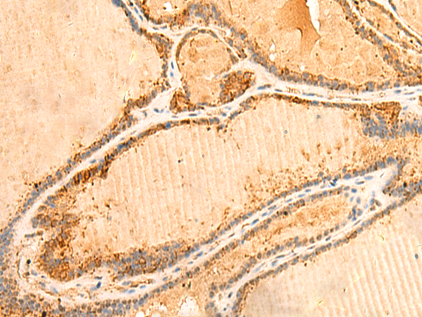 Immunohistochemistry: SP-D antibody (Clone: VIF11) staining of Rat Lung Frozen Section