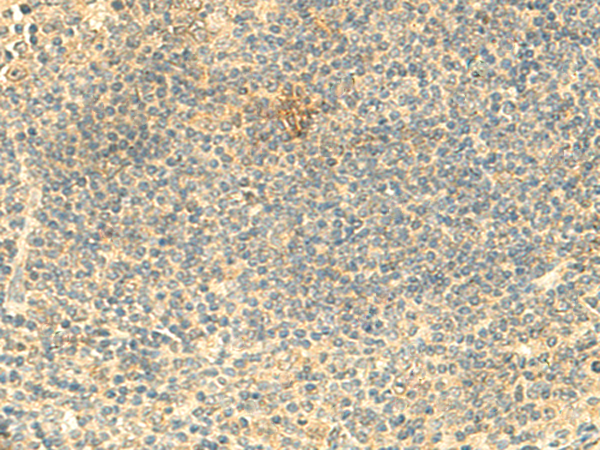 Mouse anti-Macrophage F4/80 antigen antibody Cat.-No BM4008F (5 ug/ml) on Raw 204.4 cells. Cells were fixed in 1% PFA, permeabilized in 0.25%Triton X 100 in PBS, blocked in 1% BSA in PBS.