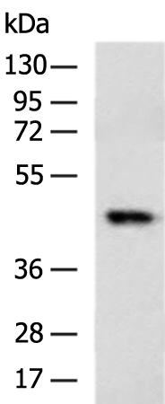 Gel: 8%SDS-PAGE Lysate: 40 microg Lane: A549 cell lysate Primary antibody: TA366163 (HS1BP3 Antibody) at dilution 1/900 Secondary antibody: Goat anti rabbit IgG at 1/5000 dilution Exposure time: 1 minute