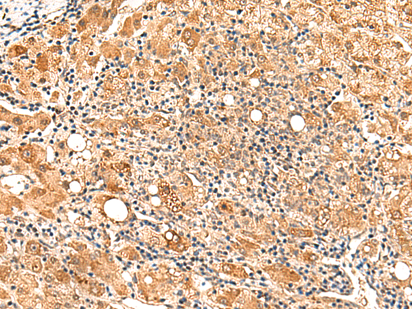 Immunohistochemistry on Mouse Liver Frozen Sections using Fibroblast Antibody Cat.-No BM4018 clone ER-TR7.